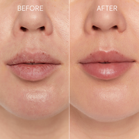 GLOV® Kiss&Kiss Set- Zestaw do peelingu ust –