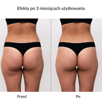 Rękawica do peelingu i mycia ciała GLOV® –