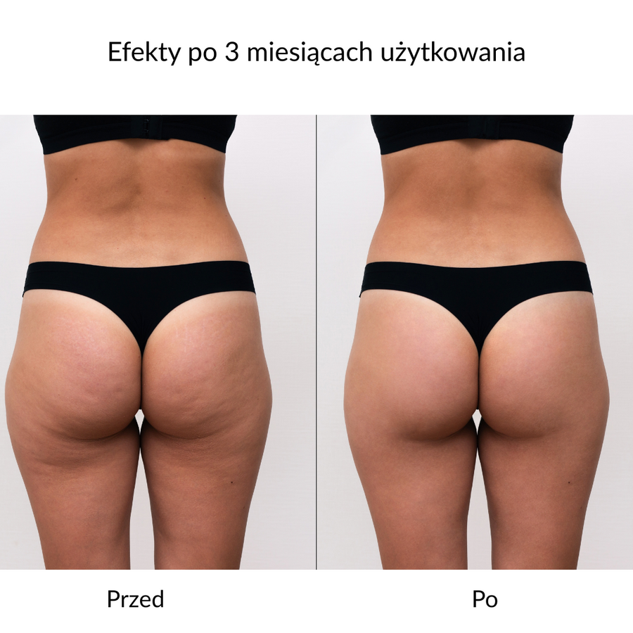 Rękawica do peelingu i mycia ciała GLOV® – 